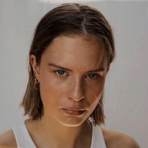 How Often Should You Get Microneedling? A Guide to Scheduling Treatments