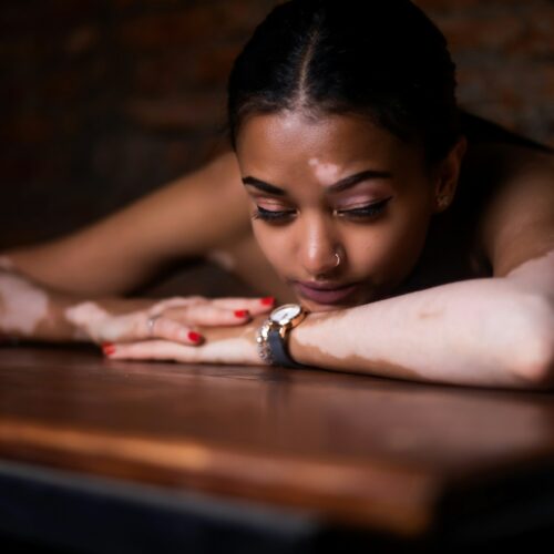 PTSD Treatment Centers — What You Need to Know Before You Choose