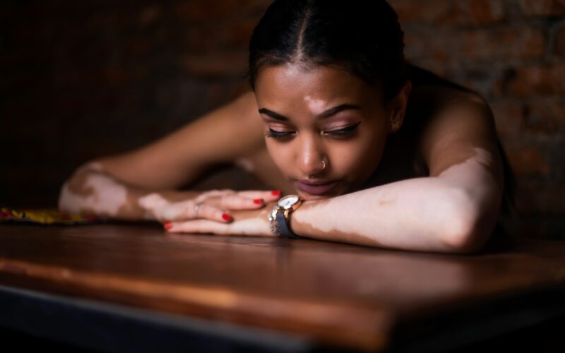 PTSD Treatment Centers — What You Need to Know Before You Choose